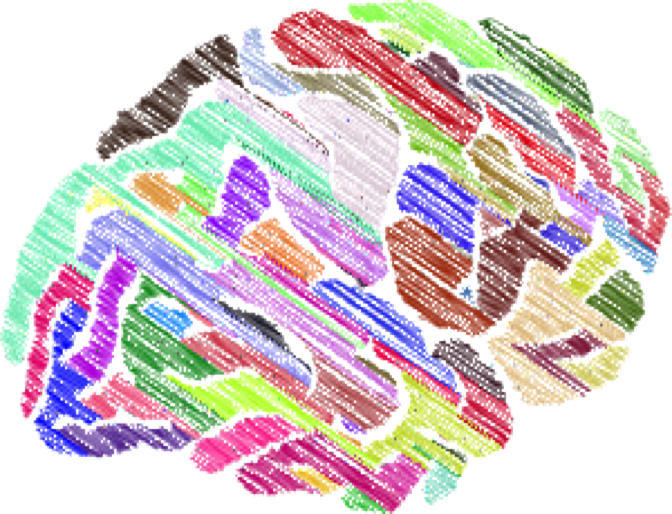 brain-2789677_1280